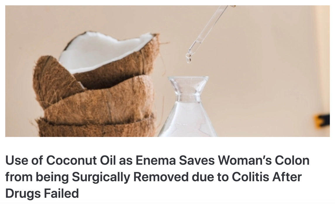 ココナッツオイルの浣腸で大腸炎が改善!?